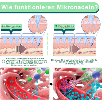 🔥🔥🔥【Letzter Aktionstag – 60 % RABATT! 🔥】Blizkox® ✨𝑨𝒅𝒆𝒍𝒈𝒂𝒛𝒂𝒎𝒊𝒆𝒏𝒕𝒐 𝑷𝑨𝑹𝑪𝑯𝑬 𝑫𝑬 𝑵𝑨𝑵𝑶𝑴𝑰𝑪𝑹𝑶𝑨𝑮𝑼𝑱𝑨𝑺 👑(Schmerzlose, kontinuierliche Wirkung für 24 Stunden | Schneller Gewichtsverlust: bis zu 9 kg | Senkt den Blutzucker um bis zu 90 %)15（副本）